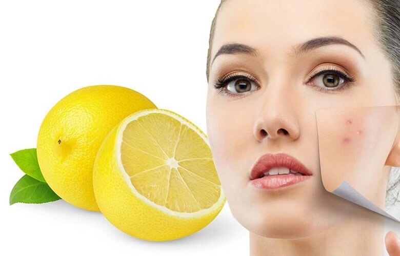 از بین بردن جوش های صورت نوجوانان,از بین بردن جوش های صورت چرب,برای از بین بردن جوش های صورت