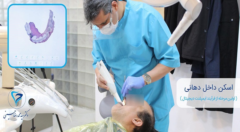 دندانپزشکی دیجیتال ایمپلنت دیجیتال,ایمپلنت های دیجیتال,دندانپزشکی دیجیتال در تهران