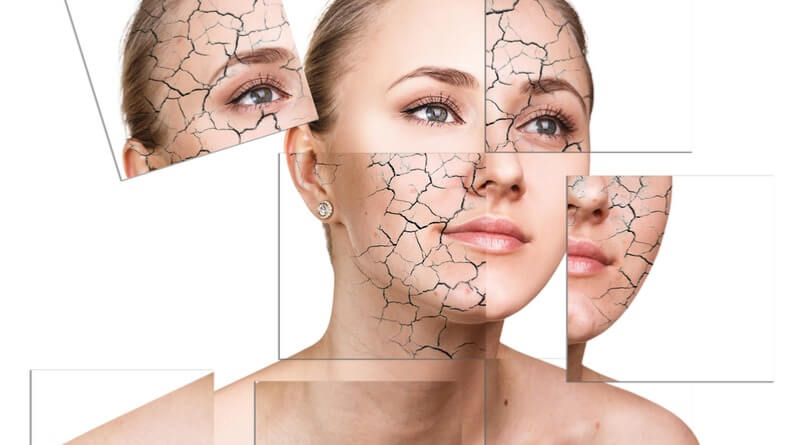 روش مراقبت از پوست چرب,روش های مراقبت از پوست مختلط,روشهای مراقبت از پوست