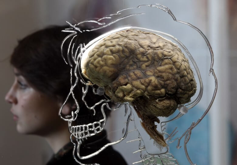 آناتومی بدن زنان,بدن زنان,آناتومی بدن زنان