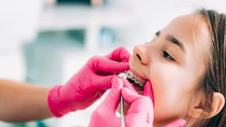 نکات مهم درباره ارتودنسی,نکاتی درباره ارتودنسی,نکاتی درباره ارتودنسی دندان